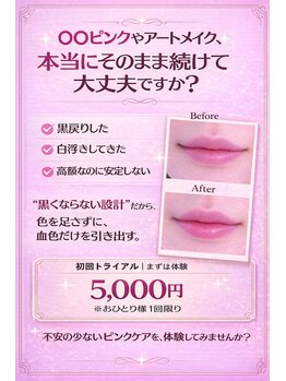 ノア 博多(Noah)の写真/唇のくすみが気になる方【血色感×透明感UP!】唇本来の発色へ唇改革!ピンクトーンで血色リップケア!