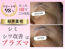 ルビー(RUBY)の雰囲気（40代50代のシミ・シワ・たるみ・毛穴のお悩みに寄り添います）