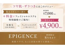 エピジェンスの雰囲気（脱毛された方に限り＋料金でエステ体験）