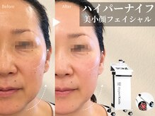 エステティックサロン アールグレー