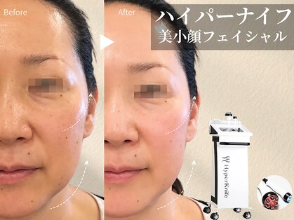 エステティックサロン アールグレーの写真