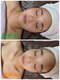 ソルモカ(SOLMOCA)の写真/自分史上最高の美肌を叶える美白ケア◇シミや乾燥によるくすみにアプローチし均一な艶肌へ