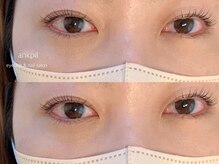 アノカプイル(ankpil)/【パリジェンヌラッシュリフト】