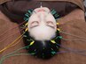 【身体と顔のケア/メンテナンス】美容鍼(身体,顔頭)+パルス(電気鍼) 40分