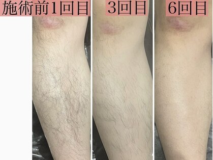 シエル(ciel)の写真