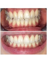 ライトビューティー 池袋店(LightBeauty)/症例写真