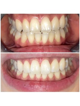 ライトビューティー 池袋店(LightBeauty)/症例写真