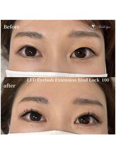 スウィートアイズ(Sweet eyes)/LEDバインドロック100束