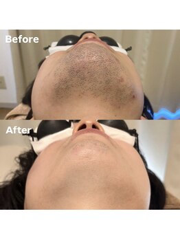 ラティア(Ratia)/