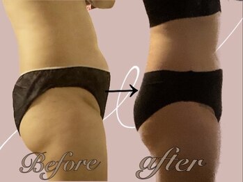 ヨサパーク ピュアン(YOSA PARK)/横から見てもスッキリ