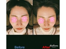 美容矯正サロン レレポノ(LELEPONO)/小顔施術