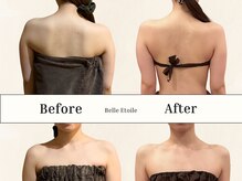 華奢背中へスタイルUP☆肩甲骨はがし/キャビ痩身/3日間ファス