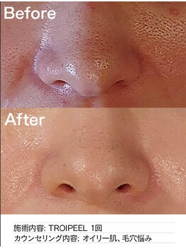 サロン ド セイ(Salon de SEI)/トロイピール