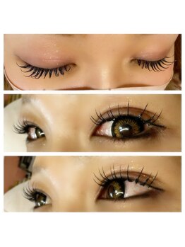 アアルズ(R’s)/