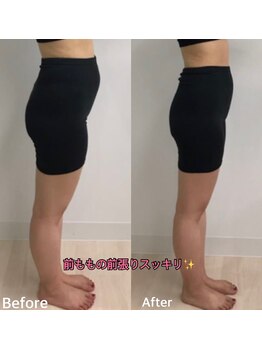セラビシャン/before→after【前もも】