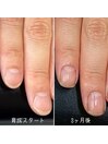 自爪育成3ヶ月コース
