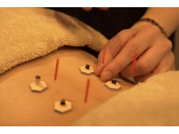 ビゴー鍼灸院 円山院(bigo鍼灸院)の写真/新しいアプローチの鍼灸整骨院が円山に登場!〈美容鍼＋ボディ鍼灸施術〉で美しく健康な毎日をプロデュース!