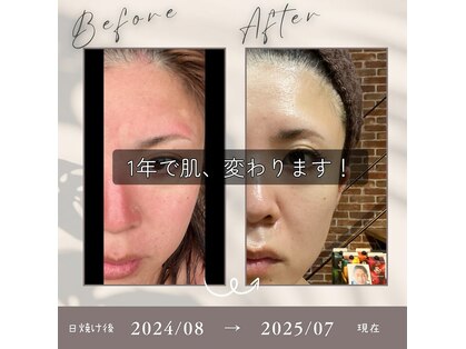 アーユルヴェーダサロン チッタ(chitta)の写真