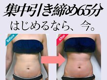 ベル アージュの雰囲気（【痩身】気になる部分を集中ケア！徹底引き締め　初回65分¥3850）