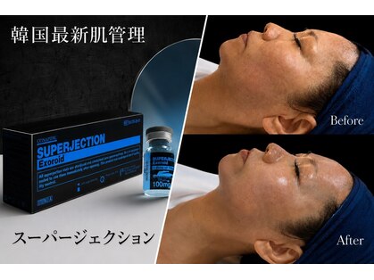 ディア(Deer)の写真