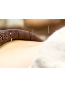 スゴ腕の施術者がいるサロン