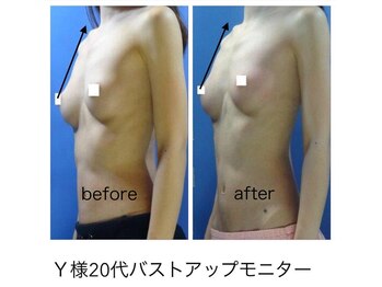 エステージ(estage)/