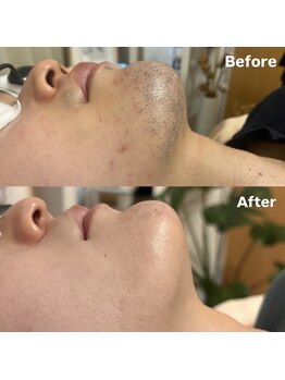 ラティア(Ratia)/