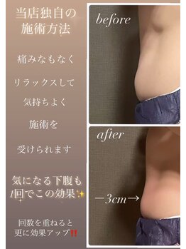 イーストモア(EAST MOIS)/マイナス3センチ☆