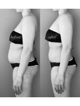 ウズ バイ プカプカ(Uzu by pukapuka)/【青木担当】整体5分での変化