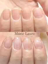 マリーロール 天王寺店(Marie Laure)/自爪育成/深爪矯正/ネイルケア