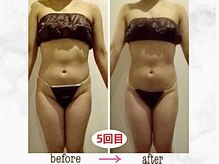 ナチュラーレ 京都四条烏丸店(Naturale)/リンパマッサージ痩身ダイエット