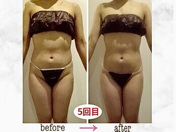 ナチュラーレ 京都四条烏丸店(Naturale)/リンパマッサージ痩身ダイエット