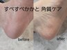 すべすべかかとに♪フット【角質ケア】4,000