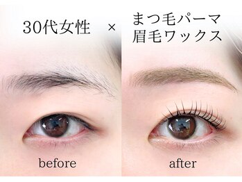 セイン 根津 千駄木(Sein)/ご結婚式前は特別綺麗に☆