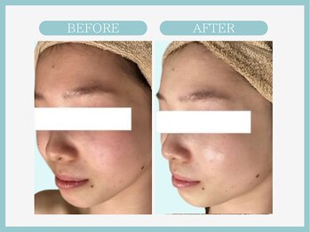 アコガレコガオ 秋田店/