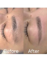 ビメ 中央林間(BEME)/Before・After