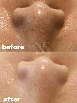 ナチュラ ソース(NatureSouce)/