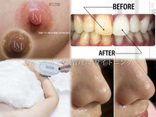 ルナベル(Luna Bell)