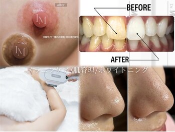 ルナベル(Luna Bell)