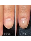 自爪育成3ヶ月コース