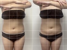 インナーメス(INNER MES)/お腹に注目！！