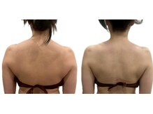 サンク アール(CinQ-R. 美九)/ブライダル