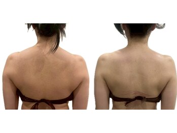 サンク アール(CinQ-R. 美九)/ブライダル