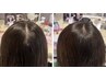 新規≪つむじだけでなく、全体的にボリュームが減ってきた方≫1500本集中