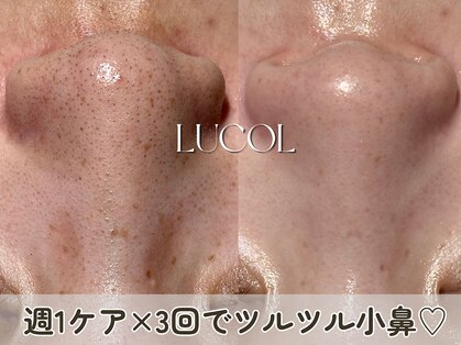 ルコル(LUCOL)の写真