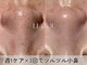ルコル(LUCOL)の写真