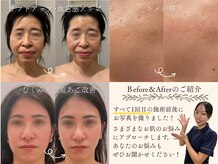 モリタ鍼灸整骨院