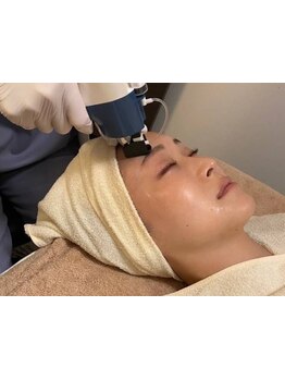 小顔になりたい