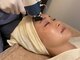 リョウ(RYO)の写真/お肌の内側から溢れるハリ艶感！エイジングケアで大人気の”エクソソーム”で見惚れるほどの美肌を叶える♪