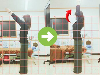 サプライズ整体院/3.0代ママさんの肩こり初回結果